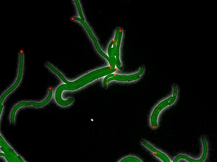 CAPTION This image shows E. coli cells under the stress of DHFR-targeting antibiotic trimethoprim in a 2015 study done prior to the research reported in this paper. The green color comes from GFP protein fused to DHFR and shows the uniform distribution of DHFR. The red color shows location of inclusion bodies of aggregated proteins in the cell. CREDIT Courtesy of Eugene Shakhnovich