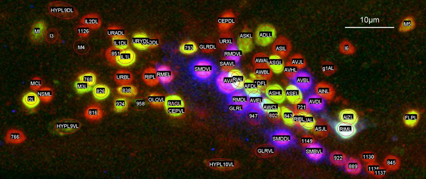 CAPTION Nerve cells are shaped like young plants: big round seeds (cell bodies) surrounded by a nest of frizzy roots in one direction (dendrites) and a single long stem stretching out in the other direction (axon). This image shows variations in the location of some neuron cell bodies between different animals as ellipses. Each neuron is randomly colored. Neurons are arranged top-to-bottom and left-to-right in the graph as they are located nose-to-tail (anterior-posterior) and back-to-belly (dorsal-ventral) in a worm.  CREDIT CC BY-ND 4.0 Toyoshima et al., 2020, DOI: 10.1186/s12915-020-0745-2