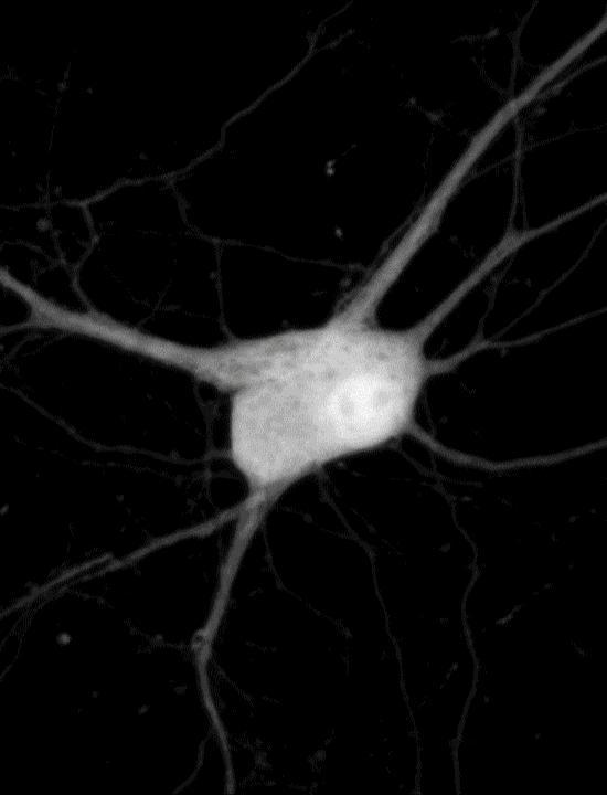 CAPTION To visualize cellular signals within a neuron, researchers scattered reporters in clusters (green) across the cell. They then identified the signal each cluster represented (multiple colors).  CREDIT C. Linghu, S. Johnson et al./Cell 2020