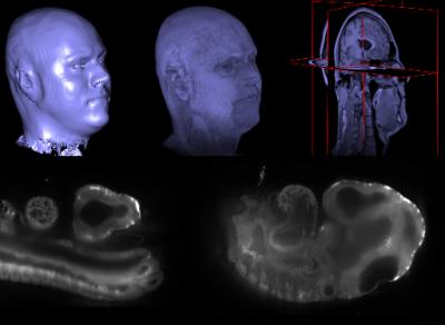 An open platform revolutionizes biomedical-image processing.  Credit: MIT.