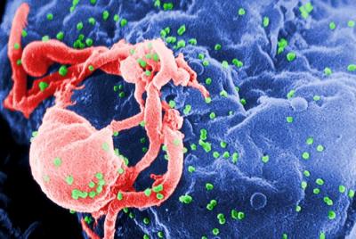 HIV virus evolution studied through supercomputer modeling