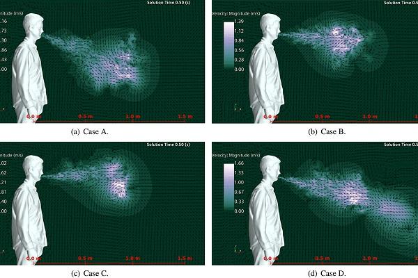 Sneeze velocity for four different nose and mouth types is shown. A is open nasal passage with teeth, B is open nasal passage without teeth, C is blocked nasal passage without teeth, and D is blocked nasal passage with teeth.