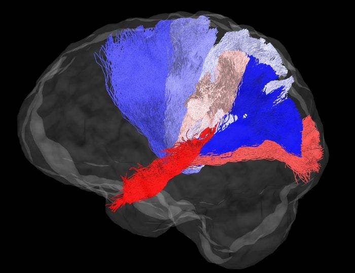 The image shows connections between the midbrain and various regions of the neocortex. Connections to each region are shown in a different colour, and were all estimated with diffusion MRI and tractography in the living human brain  CREDIT Varsha Sreenivasan and Devarajan Sridharan