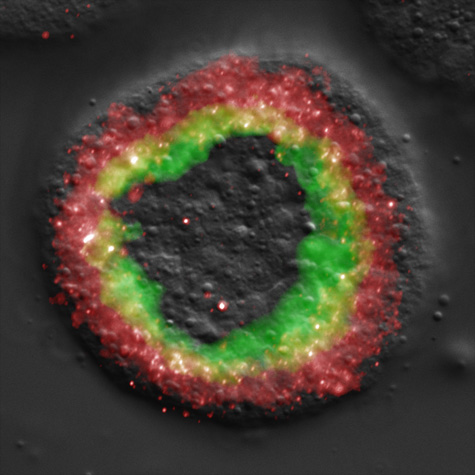 This image of a sea-urchin embryo shows where two different regulatory genes are being expressed, labeled in fluorescent green and red. [Credit: Caltech/Isabelle Peter]